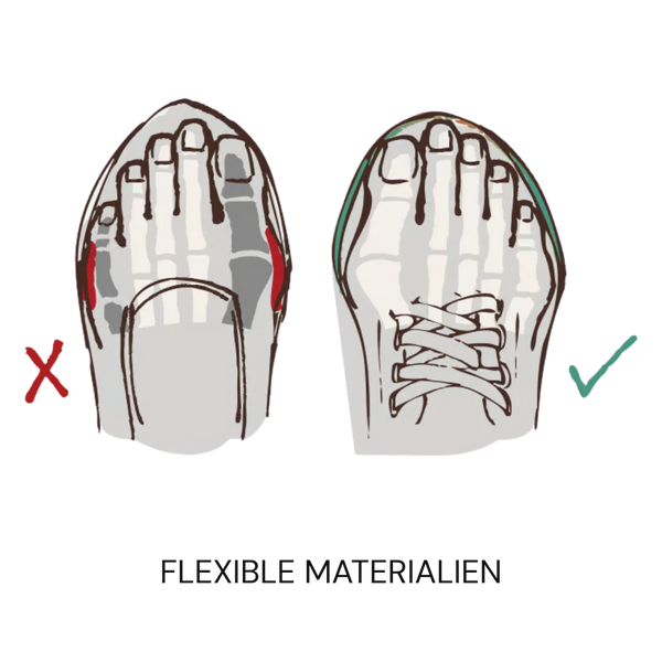 Hallux Valgus (Ballenzehen)